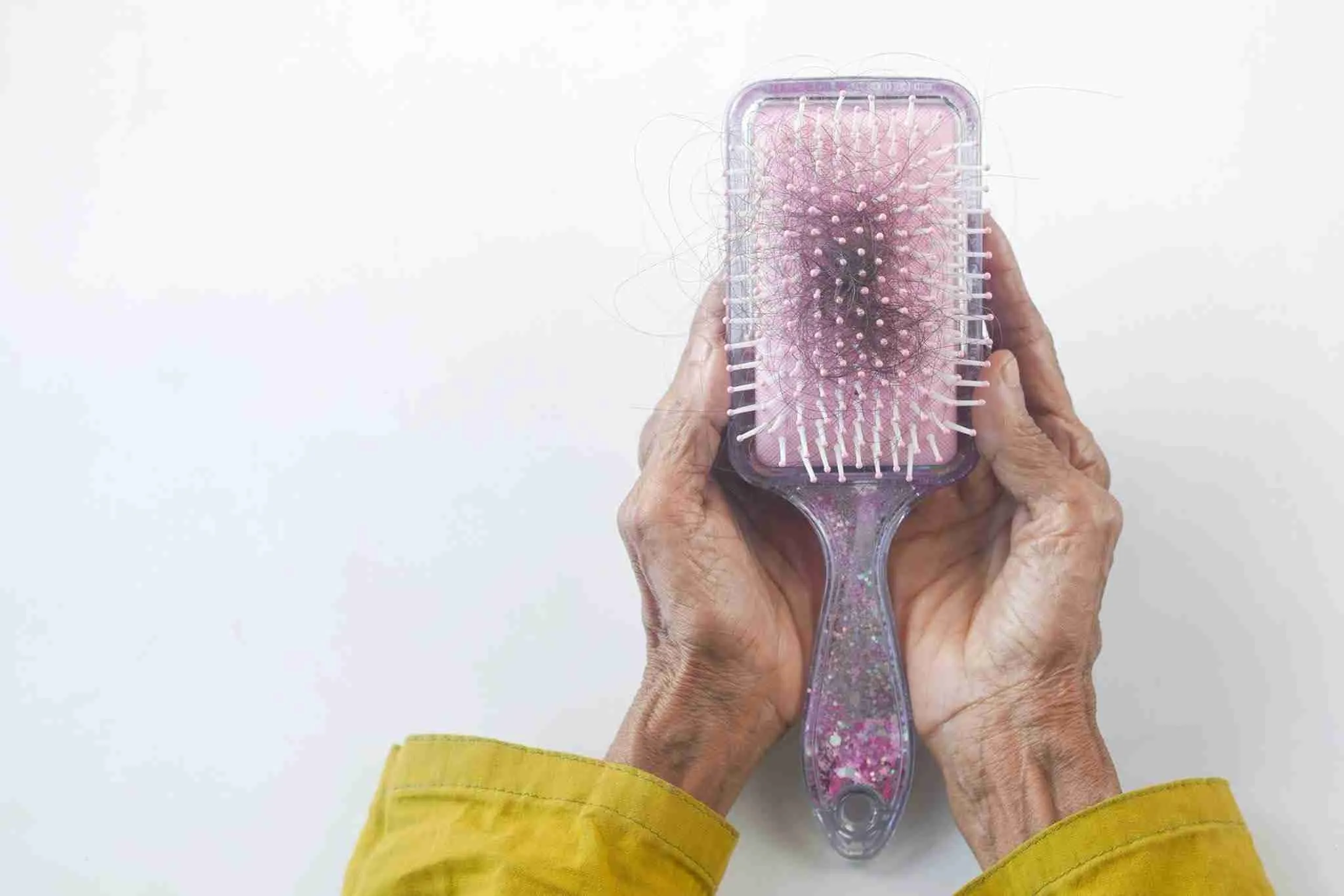 Common Causes of Hair Loss: A Deeper Look