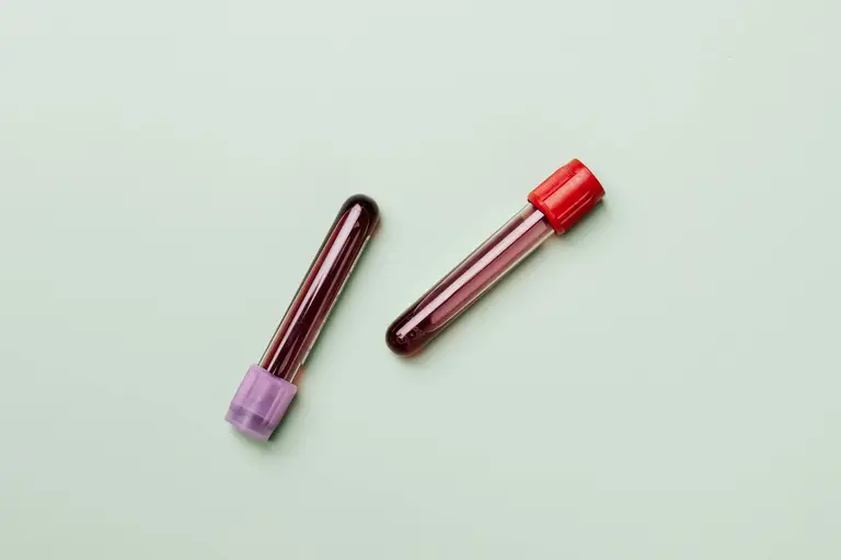 Blood sample test tubes on a light background representing cortisol laboratory measurement