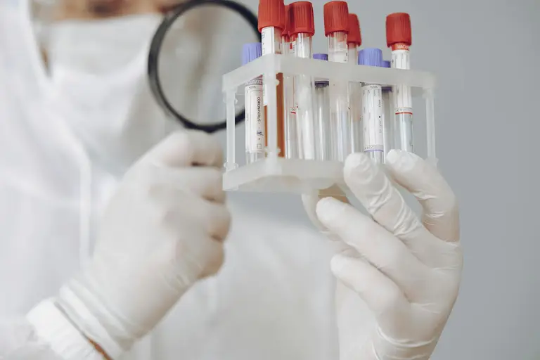 Lab technician examining a complete blood count panel