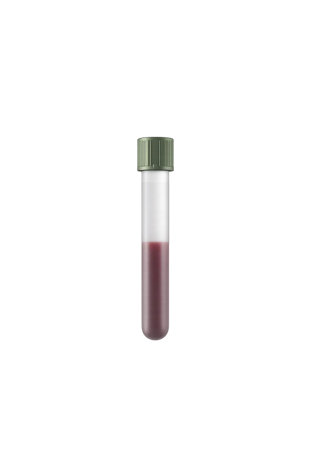 Lipoprotein Particle Panel (NMR)