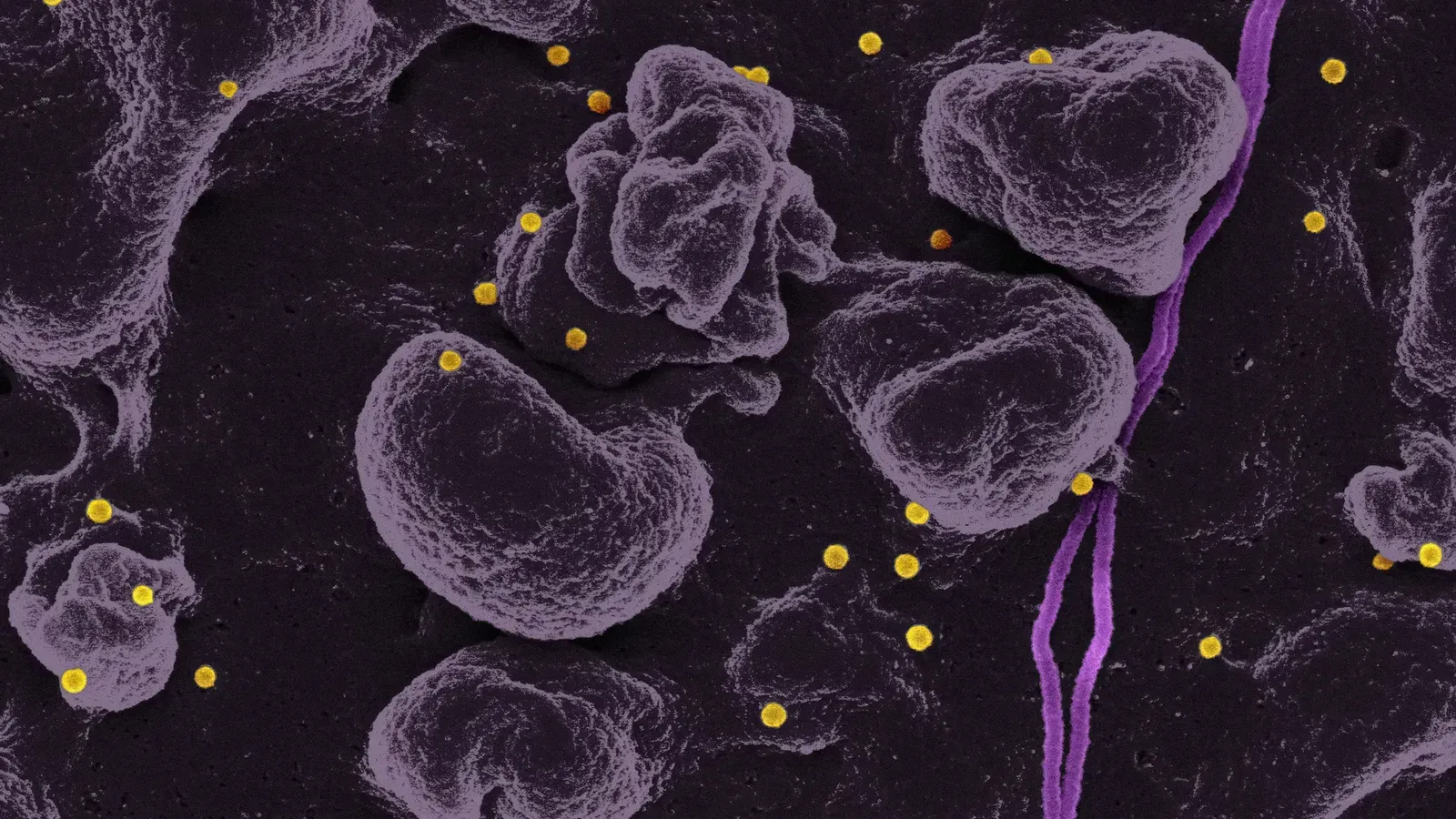 Low Ferritin Symptoms: Causes, Signs & What to Do