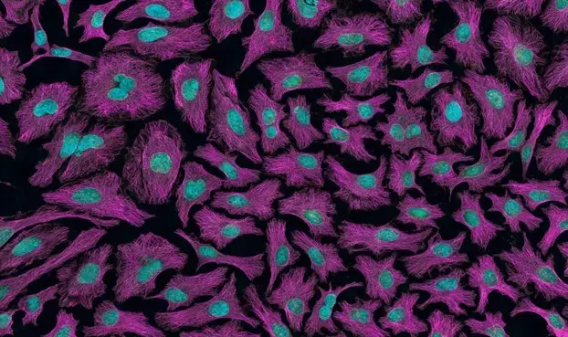 Could Low Magnesium Raise Your Prostate Cancer Risk? Recent Study Suggests Yes