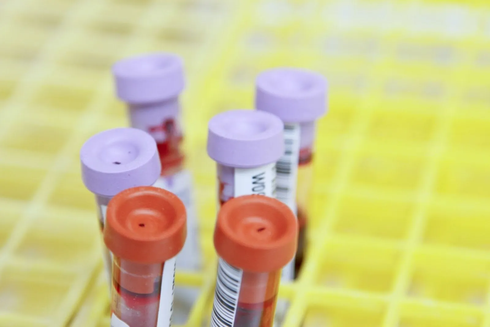 What is hs-CRP and Why Does It Matter