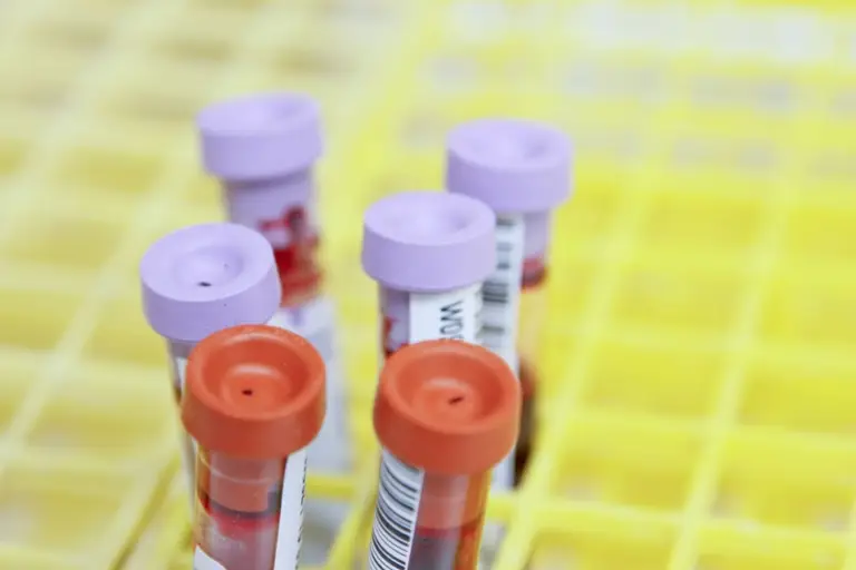 A blood test can measure high-sensitivity C-reactive protein