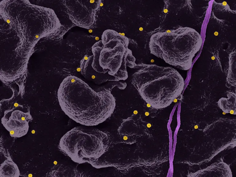 Progesterone vs LH: Key Differences Explained