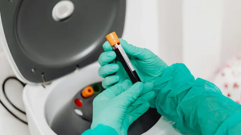 WBC Differential Explained: What Neutrophils, Lymphocytes, and Monocytes Reveal