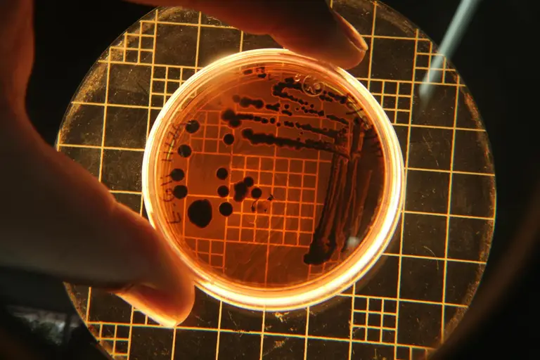 Bacterial colonies in a petri dish under microscope representing gut microbiome sequencing