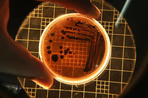 Bacterial colonies in a petri dish under microscope representing gut microbiome sequencing