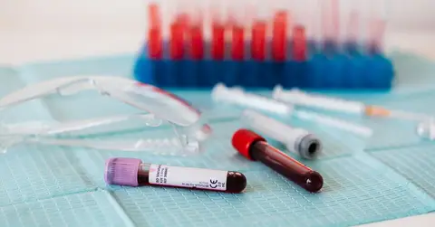 Iron Panel Cost: What an Iron Panel Costs Across Labs