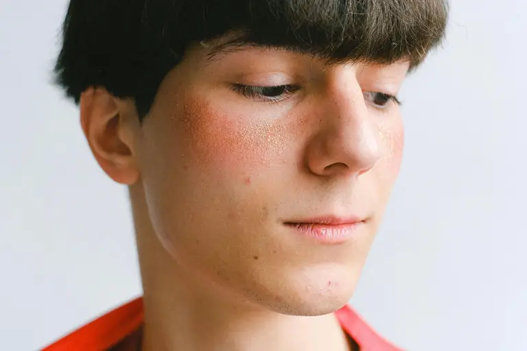 Understanding Lupus: Your Guide to Autoimmune Testing for Better Health