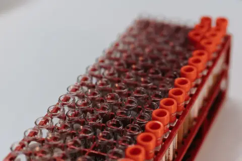 Fasting for Blood Work: What You Can Have and How to Prepare