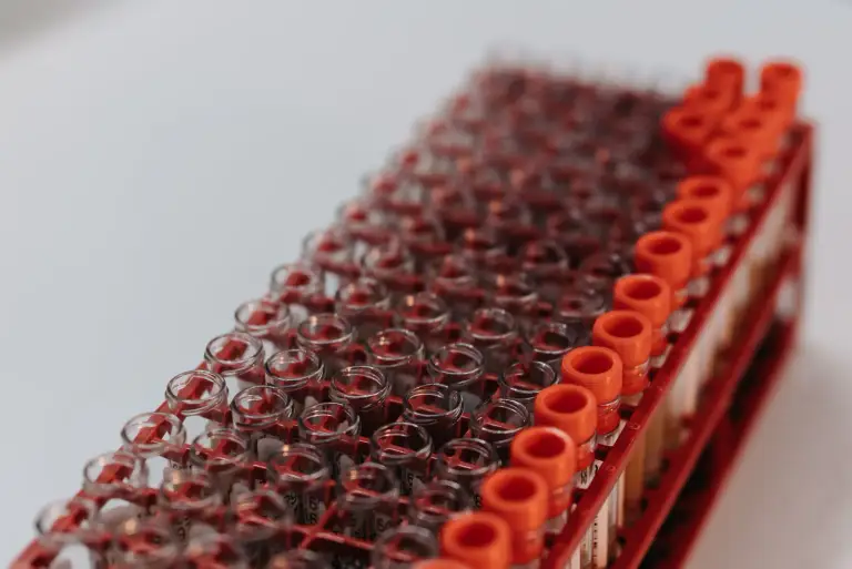 Fasting for Blood Work: What You Can Have and How to Prepare