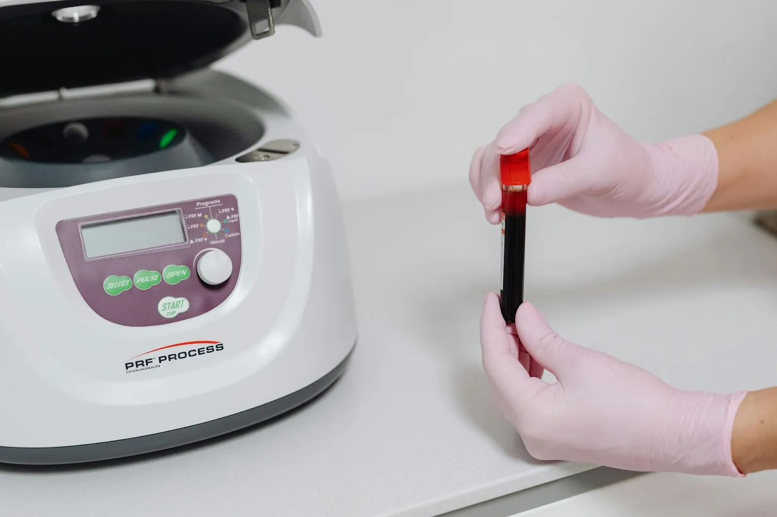 Why Blood Tests Might Miss Magnesium Problems